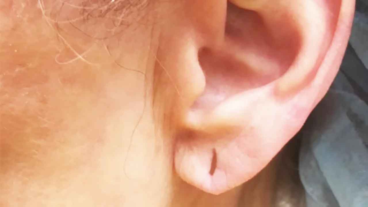 ear2