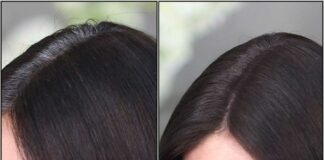 hair
