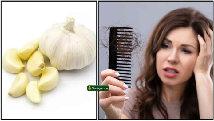hair-fall-garlic-poondu