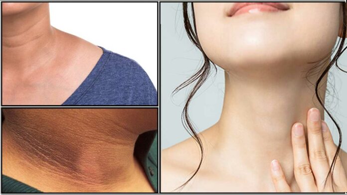 dark neck