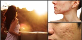 skin problem