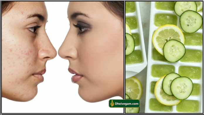 ice cube for face