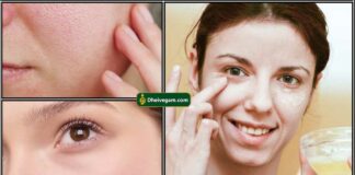 open pores