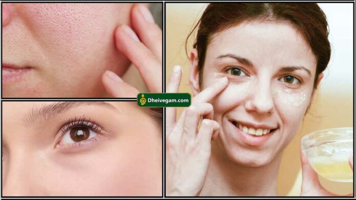 open pores