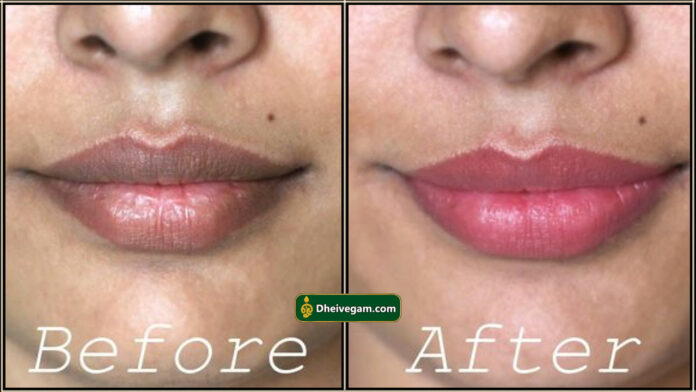 lips