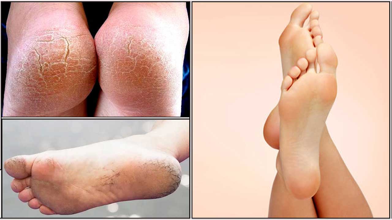 foot