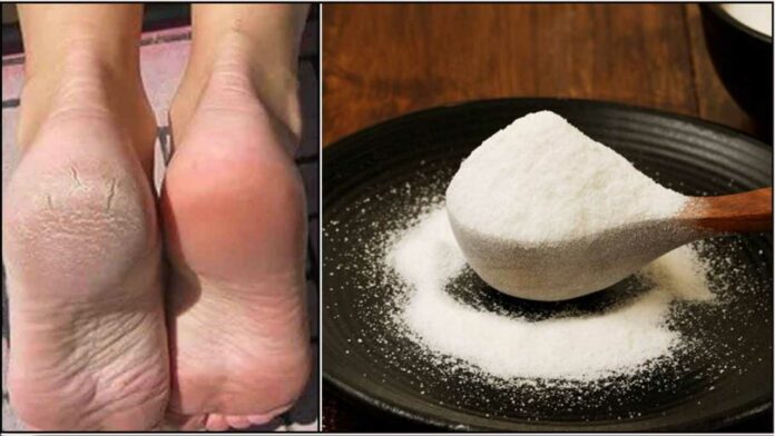 foot crack rice flour