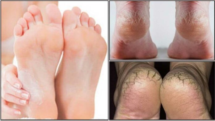 foot tips