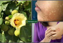 poovarasan skin disease