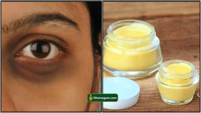 dark circle cream