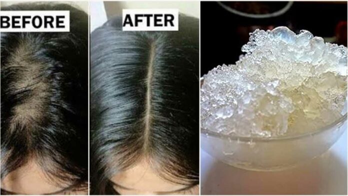 hair fall remedy