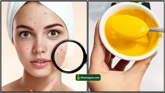 karumpulli maraiya face pack