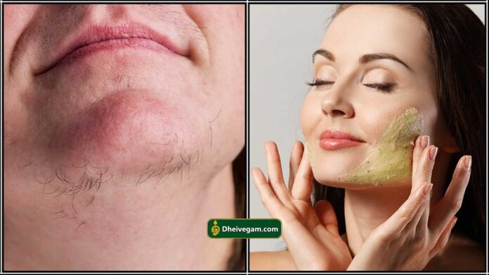 unwanted hair face pack