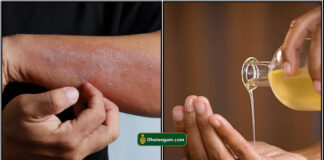 skin pbm