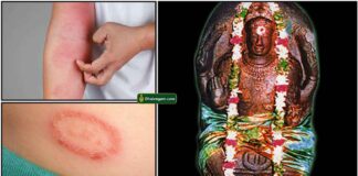 skin-prob-budhan