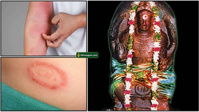 skin-prob-budhan