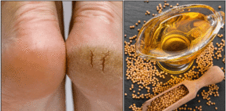 crack feet oil