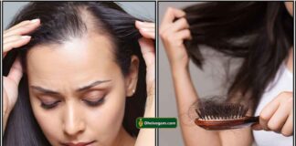 hair-loss