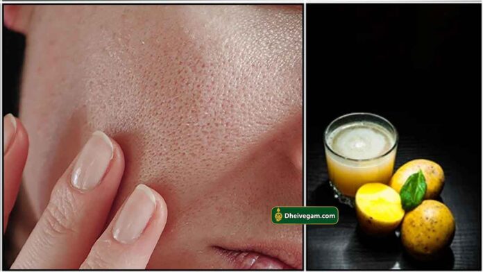 open-pores-potato