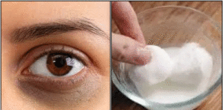 கருந்திட்டுகளும் கருவளையமும் நீங்க dark circles