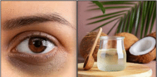 கண்களை சுற்றி இருக்கும் கருவளையம் காணாமல் போக dark circle coconut oil