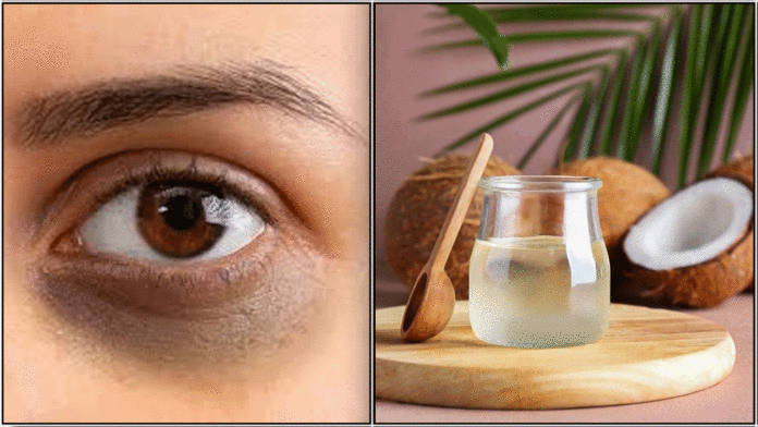 dark circle coconut oil