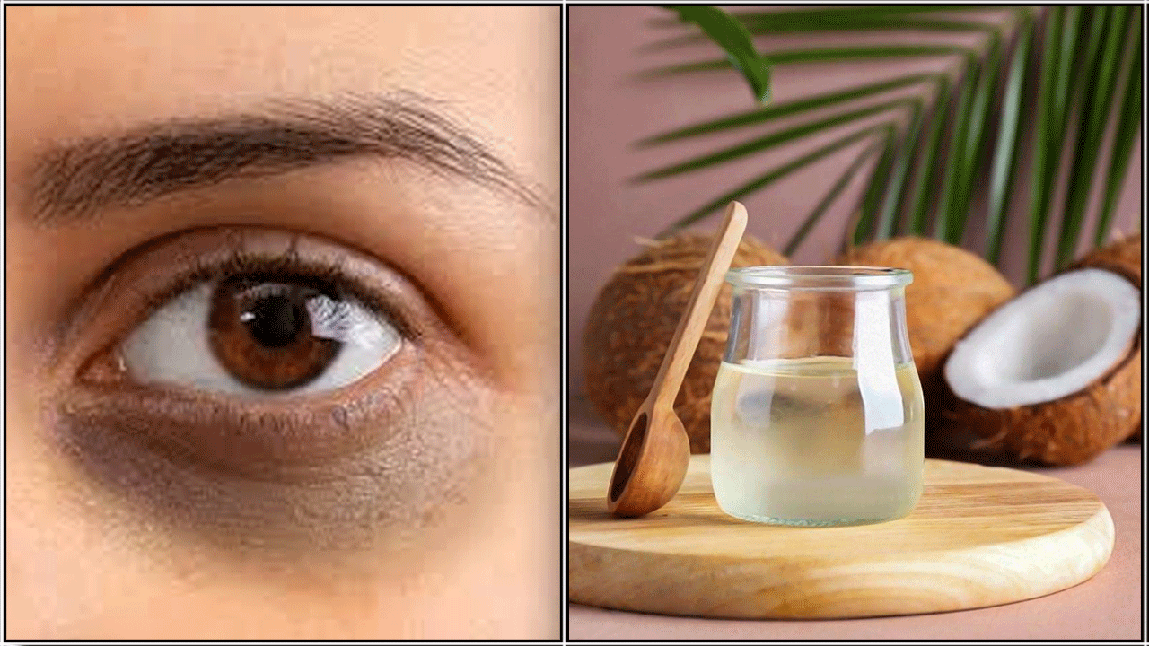 dark circle coconut oil