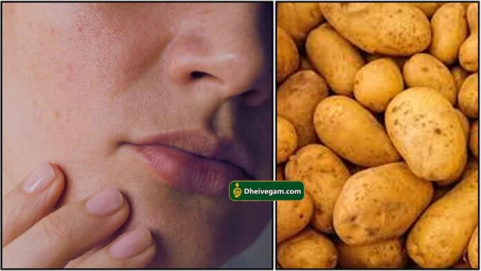 rough-skin-potato