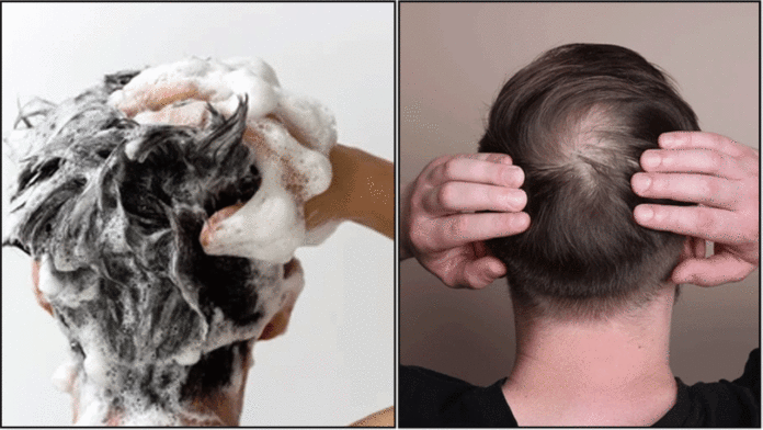 hair
