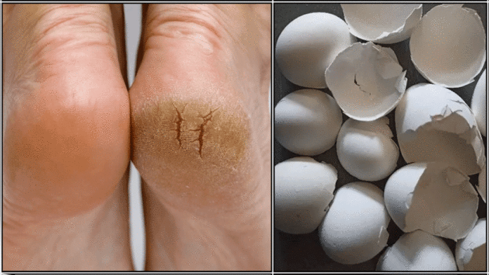 foot egg shell