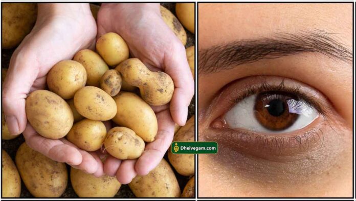 potato-eye-dark-circle