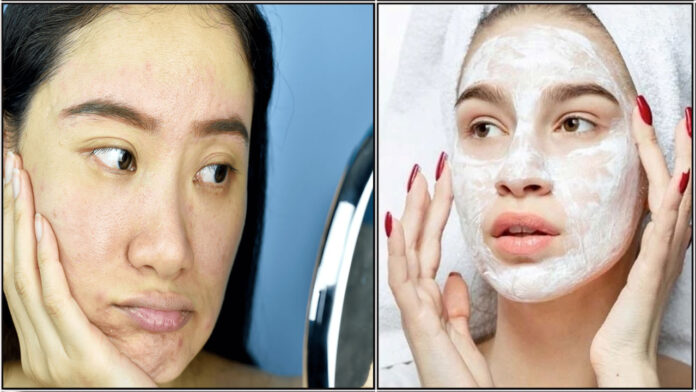 face pack